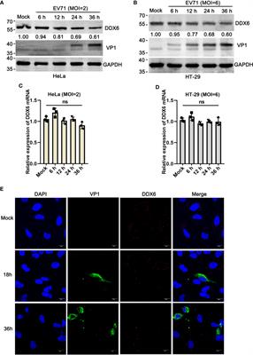 DEAD-Box Helicase DDX6 Facilitated RIG-I-Mediated Type-I Interferon Response to EV71 Infection